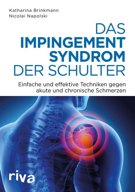 Nicolai Napolski: Das Impingement-Syndrom der Schulter, Buch
