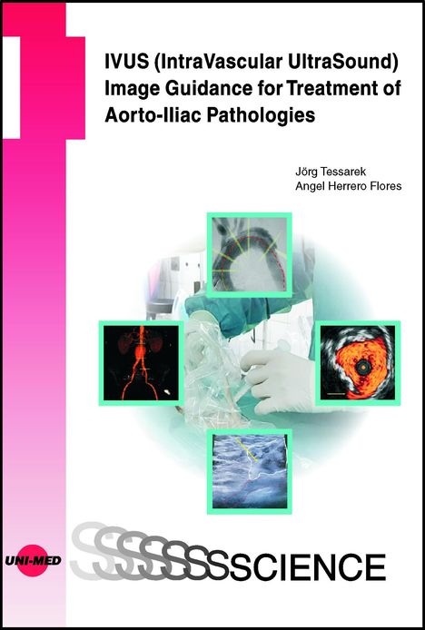 Jörg Tessarek: IVUS (IntraVascular UltraSound) Image Guidance for Treatment of Aorto-Iliac Pathologies, Buch