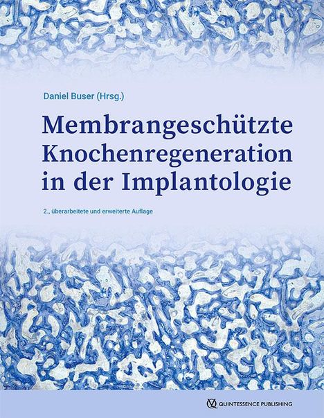 Membrangeschützte Knochenregeneration in der Implantologie, Buch