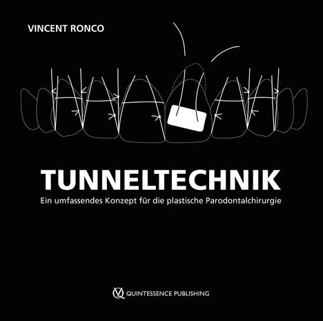 Vincent Ronco: Tunneltechnik, Buch