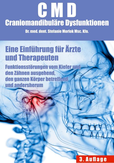 Text über CMD und Kieferdysfunktionen, Illustration eines Schädels in blau mit rotem Akzent im Kieferbereich.