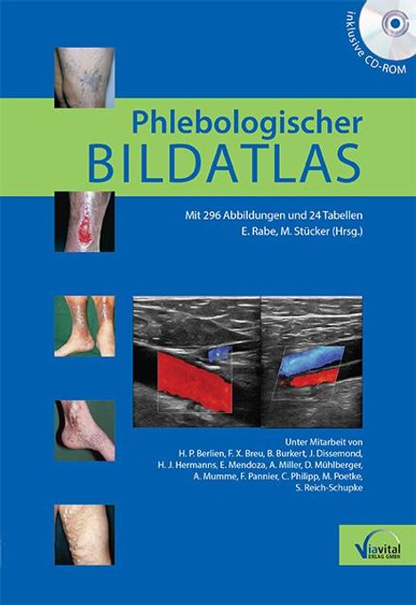 Phlebologischer Bildatlas, Buch