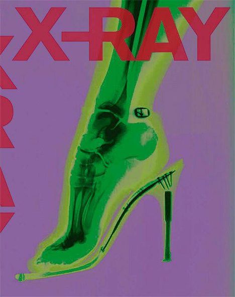 Text: "X-RAY". Eine Röntgenaufnahme eines Fußes in einem hochhackigen Schuh, farblich in Grün und Lila gehalten.