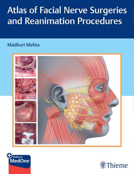 Madhuri Mehta: Atlas of Facial Nerve Surgeries and Reanimation Procedures, 1 Buch und 1 Diverse