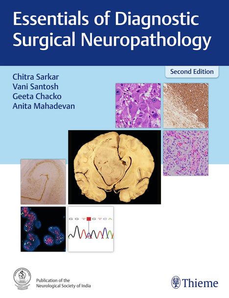 Essentials of Diagnostic Surgical Neuropathology, Buch