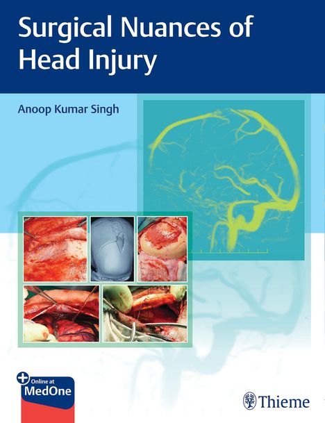 Anoop Kumar Singh: Surgical Nuances of Head Injury, 1 Buch und 1 Diverse