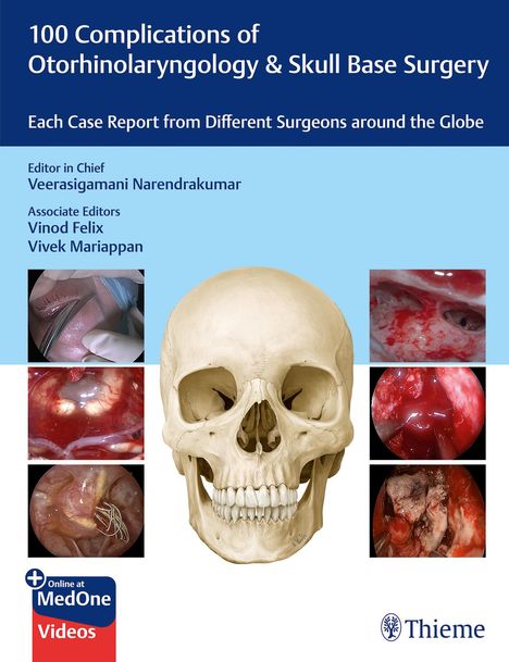 100 Complications of Otorhinolaryngology &amp; Skull Base Surgery, 1 Buch und 1 Diverse