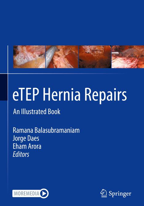 "eTEP Hernia Repairs: An Illustrated Book" von Ramana Balasubramaniam, Jorge Daes, Eham Arora. Oben Operationsfotos.