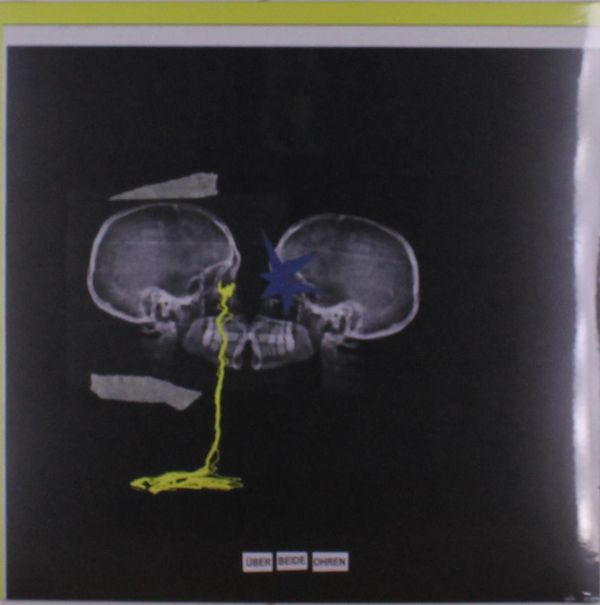 Nikra: Über beide Ohren (Yellow-Transparent White Vinyl) (Vinyl-LP)
