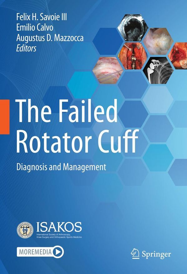 The Failed Rotator Cuff (Buch)