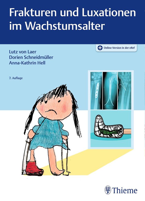 Frakturen und Luxationen im Wachstumsalter - Lutz von Laer (Buch)