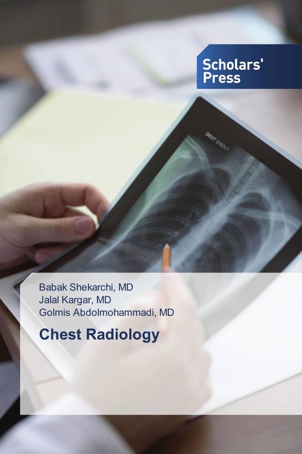 Chest Radiology - Md Shekarchi (Buch)