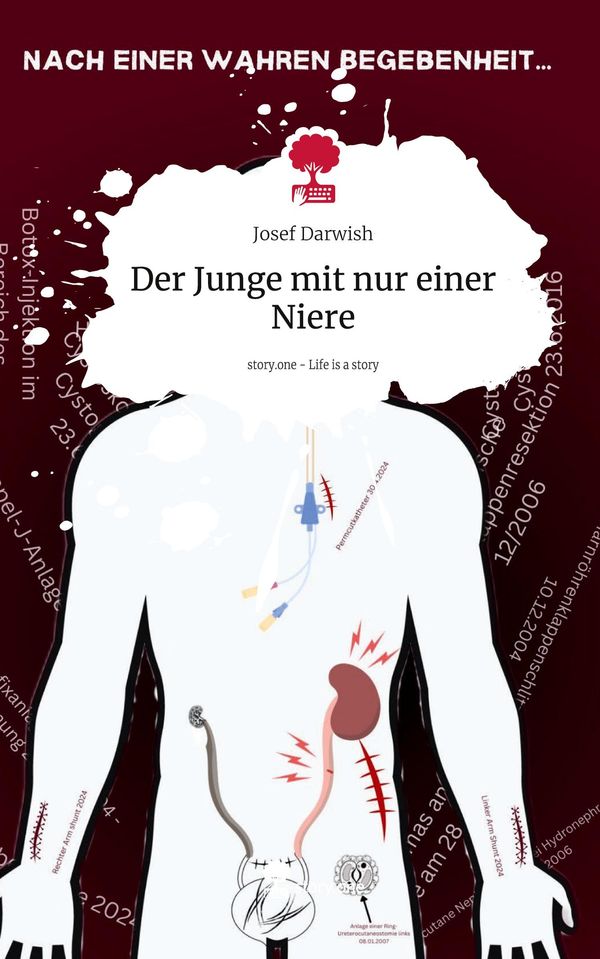 Der Junge mit nur einer Niere. Life is a Story - story.one (Buch)