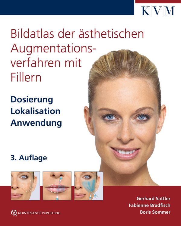 Bildatlas der ästhetischen Augmentationsverfahren mit Fillern (Buch)