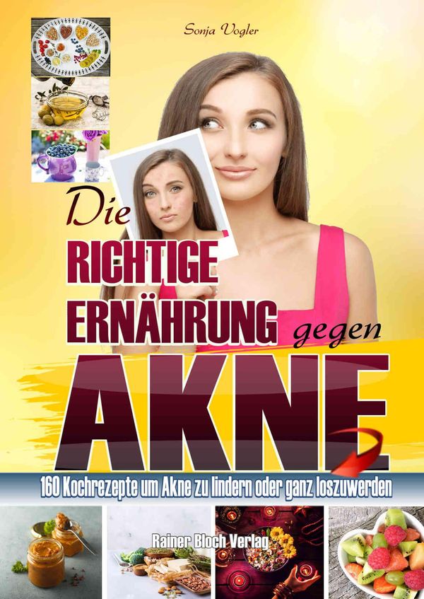 Die richtige Ernährung gegen Akne - Sonja Vogler (Buch)