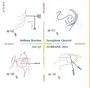 Anthony Braxton: Sax Qt (Lorraine), CD,CD,CD,CD