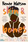 Renée Watson: Skin & Bones, Buch