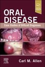 Carl M Allen: Oral Disease: Case Studies of Difficult Diagnoses, Buch