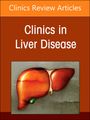 : Navigating the Management of Hepatocellular Carcinoma, An Issue of Clinics in Liver Disease, Buch