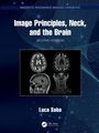 "Image Principles, Neck, and the Brain, Second Edition. Luca Saba." Vier MRT-Bilder des Gehirns und Nackens auf dunklem Hintergrund.