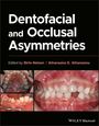 Melsen: Dentofacial and Occlusal Asymmetries, Buch