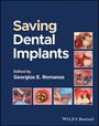 : Saving Dental Implants, Buch