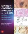 Mark Izzard: Margin Control Surgery of the Skin: Concepts, Histopathology, and Applications, Buch