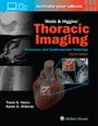 Karen Gomes Ordovas: Webb & Higgins Thoracic Imaging: Print + eBook with Multimedia, Buch