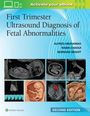 „First Trimester Ultrasound Diagnosis of Fetal Abnormalities“ steht auf blauem Hintergrund. Unten sind Ultraschallbilder.