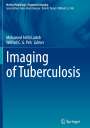 : Imaging of Tuberculosis, Buch