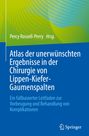 : Atlas der unerwünschten Ergebnisse in der Chirurgie von Lippen-Kiefer-Gaumenspalten, Buch