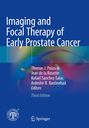 Imaging and Focal Therapy of Early Prostate Cancer, Buch