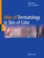 Text: "Atlas of Dermatology in Skin of Color." Autoren: Sidra Ibad, Clay J. Cockerell. Unten Springer-Logo. Bilder von Hautzuständen.