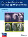 : Rigid Spine Deformities, Buch,Div.
