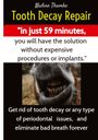 Nadine Thamke: Tooth Decay Repair, dental care, swollen gums, bad breath, dental plaque, dental caries, gum disease, teeth whitening, dental pain, Heal gum teeth, Mouth bacteria, Mouthwash, Dental braces, Gum care, Buch