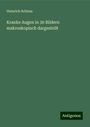 Heinrich Schiess: Kranke Augen in 30 Bildern makroskopisch dargestellt, Buch