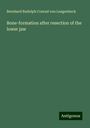 Bernhard Rudolph Conrad von Langenbeck: Bone-formation after resection of the lower jaw, Buch