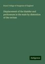 Royal College Of Surgeons Of England: Displacement of the bladder and peritoneum in the male by distention of the rectum, Buch