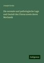 Joseph Kocks: Die normale und pathologische Lage und Gestalt des Uterus sowie deren Mechanik, Buch