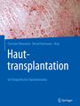 : Hauttransplantation, Buch