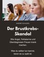 André Schudel: Der Brustkrebs-Skandal - Wie Angst, Fehlalarme und Überdiagnosen Frauen krank machen - Was du selber tun kannst, bevor es zu spät ist., Buch