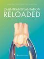 "Zahntransplantation Reloaded" von Andreas Filippi, Michelle Simonek, Fabio Saccardin. Illustration: Zahn mit Zange.
