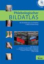 : Phlebologischer Bildatlas, Buch