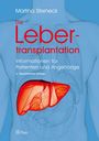 Martina Sterneck: Die Lebertransplantation, Buch