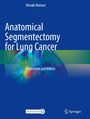 Titel: Anatomical Segmentectomy for Lung Cancer. Autor: Hiroaki Nomori. Hintergrund in Blau mit farbigen Mustern. Springer-Logo.
